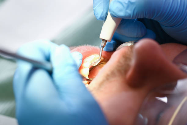 Best Emergency Gum Pain Relief  in Mcclure, PA