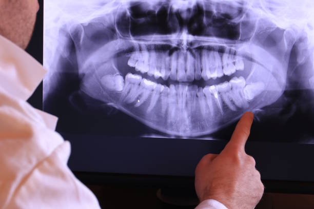 Best Tooth Pain Emergency Relief  in Mcclure, PA