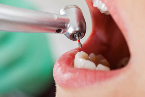 Best Broken Tooth Emergency  in Mcclure, PA